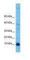 Chromosome 11 Open Reading Frame 52 antibody, orb326852, Biorbyt, Western Blot image 