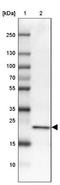 Cytochrome B-245 Chaperone 1 antibody, NBP2-14553, Novus Biologicals, Western Blot image 