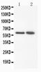 Dimethylaniline monooxygenase [N-oxide-forming] 3 antibody, PA1764, Boster Biological Technology, Western Blot image 