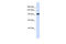 Zinc Finger BED-Type Containing 9 antibody, 26-255, ProSci, Western Blot image 