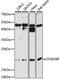 Integrin Subunit Beta 3 Binding Protein antibody, 19-892, ProSci, Western Blot image 