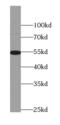 Zinc finger protein AEBP2 antibody, FNab00188, FineTest, Western Blot image 