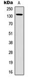 Hydroxysteroid 17-Beta Dehydrogenase 4 antibody, orb234876, Biorbyt, Western Blot image 