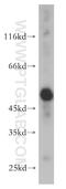 Aldehyde Dehydrogenase 1 Family Member A1 antibody, 15910-1-AP, Proteintech Group, Western Blot image 