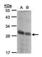 N-Ribosyldihydronicotinamide:Quinone Reductase 2 antibody, PA5-28328, Invitrogen Antibodies, Western Blot image 