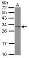 Mitochondrial Ribosomal Protein L10 antibody, NBP2-19396, Novus Biologicals, Western Blot image 