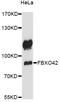 F-Box Protein 42 antibody, LS-C749880, Lifespan Biosciences, Western Blot image 