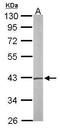 Phosphoserine aminotransferase antibody, TA307984, Origene, Western Blot image 