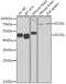 Inducible T Cell Costimulator Ligand antibody, GTX32664, GeneTex, Western Blot image 