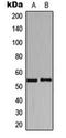 Histidyl-tRNA synthetase, cytoplasmic antibody, orb216123, Biorbyt, Western Blot image 