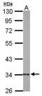 2,4-Dienoyl-CoA Reductase 1 antibody, TA307899, Origene, Western Blot image 