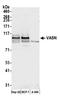 Vasorin antibody, A305-791A-M, Bethyl Labs, Western Blot image 
