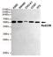 RAD23 Homolog B, Nucleotide Excision Repair Protein antibody, GTX66845, GeneTex, Western Blot image 