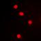 MAPK Activated Protein Kinase 3 antibody, LS-C368671, Lifespan Biosciences, Immunofluorescence image 