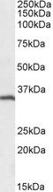 CD20 antibody, orb18296, Biorbyt, Western Blot image 
