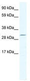 Doublesex And Mab-3 Related Transcription Factor 2 antibody, TA329587, Origene, Western Blot image 