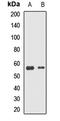 DnaJ homolog subfamily C member 7 antibody, orb412132, Biorbyt, Western Blot image 