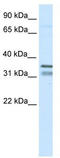 Homeobox protein Nkx-2.2 antibody, TA342285, Origene, Western Blot image 