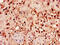 HEP antibody, CSB-PA010716LA01HU, Cusabio, Immunohistochemistry paraffin image 