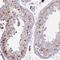 ETS Transcription Factor ELK1 antibody, NBP2-38278, Novus Biologicals, Immunohistochemistry frozen image 
