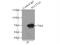 Long-chain fatty acid transport protein 4 antibody, 11013-1-AP, Proteintech Group, Immunoprecipitation image 