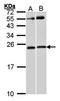 Rac Family Small GTPase 1 antibody, orb74185, Biorbyt, Western Blot image 