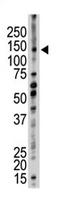 Ubiquitination Factor E4B antibody, AP11966PU-N, Origene, Western Blot image 