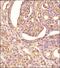 CD13 antibody, NBP2-77451, Novus Biologicals, Immunohistochemistry paraffin image 