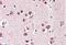 SH3GL2 antibody, orb43524, Biorbyt, Immunohistochemistry paraffin image 