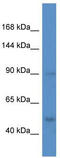 Hypoxia-inducible factor 1-alpha antibody, TA329159, Origene, Western Blot image 