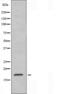 Translocase Of Outer Mitochondrial Membrane 20 antibody, orb226707, Biorbyt, Western Blot image 
