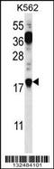 Parathymosin antibody, 56-667, ProSci, Western Blot image 