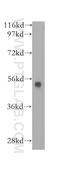 Peptidyl Arginine Deiminase 2 antibody, 12110-1-AP, Proteintech Group, Western Blot image 