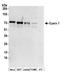 Epsin 1 antibody, A304-525A, Bethyl Labs, Western Blot image 