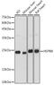 Heat Shock Protein Family B (Small) Member 8 antibody, GTX64490, GeneTex, Western Blot image 