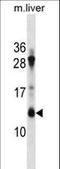 ATP Synthase Membrane Subunit C Locus 2 antibody, LS-C156657, Lifespan Biosciences, Western Blot image 
