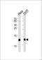 Vesicle Associated Membrane Protein 8 antibody, PA5-35300, Invitrogen Antibodies, Western Blot image 