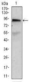 ATP Binding Cassette Subfamily B Member 5 antibody, MA5-17026, Invitrogen Antibodies, Western Blot image 