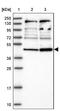 Ring Finger Protein 44 antibody, NBP1-82930, Novus Biologicals, Western Blot image 