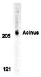 Apoptotic Chromatin Condensation Inducer 1 antibody, orb74391, Biorbyt, Western Blot image 