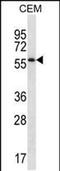Motile Sperm Domain Containing 2 antibody, PA5-48548, Invitrogen Antibodies, Western Blot image 
