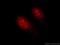 Homologous-pairing protein 2 homolog antibody, 11339-1-AP, Proteintech Group, Immunofluorescence image 
