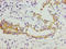 Collagen Type XI Alpha 1 Chain antibody, LS-C317845, Lifespan Biosciences, Immunohistochemistry paraffin image 