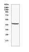Mevalonate Diphosphate Decarboxylase antibody, A01631-1, Boster Biological Technology, Western Blot image 