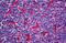 ATPase H+ Transporting V1 Subunit A antibody, MBS246304, MyBioSource, Immunohistochemistry frozen image 