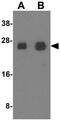 Gap Junction Protein Beta 2 antibody, GTX17229, GeneTex, Western Blot image 