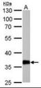 Aldo-keto reductase family 1 member C1 antibody, orb181682, Biorbyt, Western Blot image 