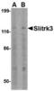 SLIT And NTRK Like Family Member 3 antibody, TA306526, Origene, Western Blot image 