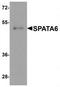 Spermatogenesis Associated 6 antibody, TA319940, Origene, Western Blot image 