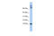 Chemokine Like Factor antibody, 26-264, ProSci, Western Blot image 